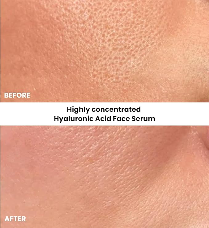 Pure Hyaluronic Acid Serum for Face with Vitamin C, Vitamin E and Green Tea, Plant-Powered Anti-Aging Hydrating Serum, Best for Firming, Repairing, Moisturizing, Plumping Fine Lines, 1 fl oz