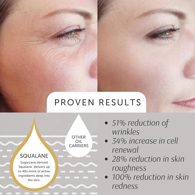 Squalane Absolute - EWG VERIFIED, for Skin Texture, Tone, and Youthful Radiance, 30ml/1oz