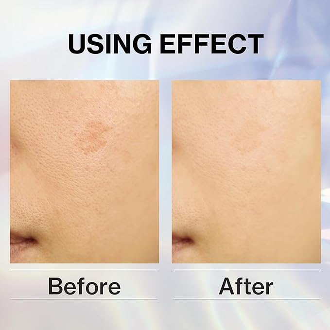 Japanese cherry blossom face cream Face Moisturizer Hydrating Sakura Rice Vitamin C “Kuramoto-no-Shizuku” Lightweight (1.76 oz)