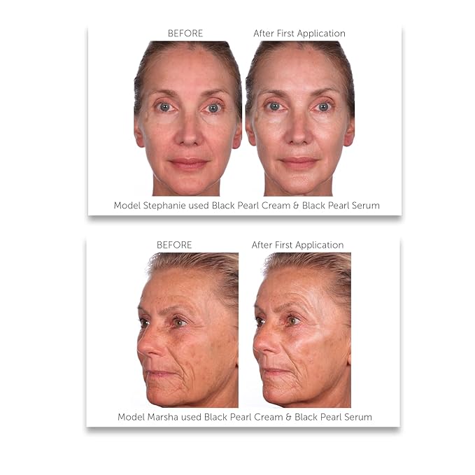 Serious Skincare Black Pearl Deep Wrinkle Decrease Face Moisturizer to Reduce Appearance of Lines & Wrinkles - Anti Aging Cream For Face & Neck with Hydrating Peptides & Caviar Extract - 1.7 oz.