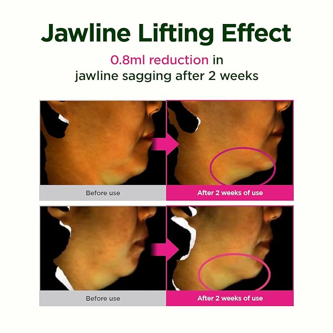 CKD Retino Collagen Gua Sha Neck Cream - Firming Cream for Neck and Jawline Tightening, Lifting, and Wrinkle Reduction with Stainless Steel Roller. Korean Skin Care,1.69 fl oz.