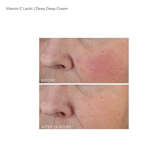 Dr Dennis Gross Vitamin C Lactic Dewy Deep Cream: Ultra-Rich, Replenishing Cream for a Dewy Finish, 2 oz