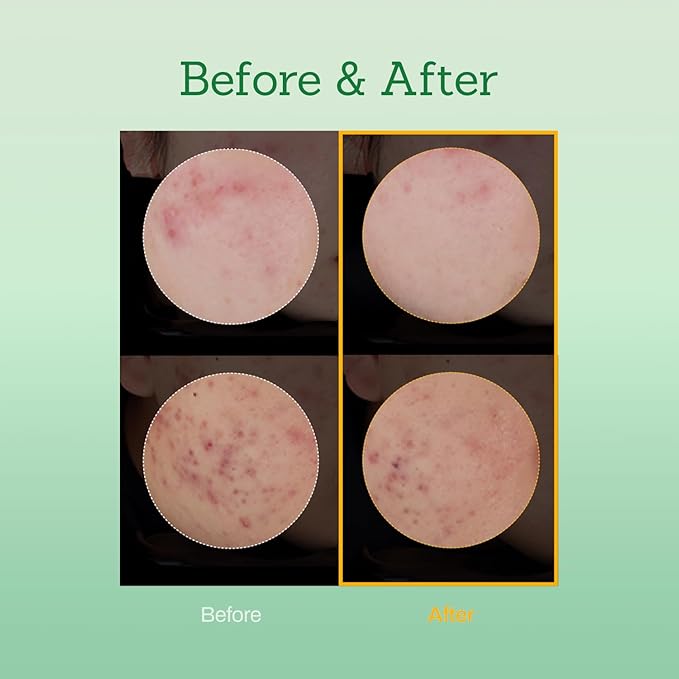 Mugwort Super Calming Toner - Korean Hydrating Toner for face, Purifying Mugwort Essence, Soothing, Calming, Refreshing Facial Toner for Oily, Dry, and Sensitive Skin, Daily Skin Care, 8.45 fl.oz