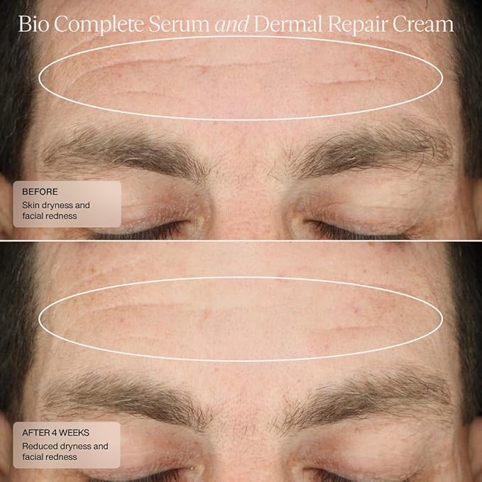 Senté Bio Complete Serum | Retinoid Serum for Sensitive Skin | Gentle, Nourishing & ﻿Hydrating | Combats Dull and Aging Skin | 1.0 Fl Oz