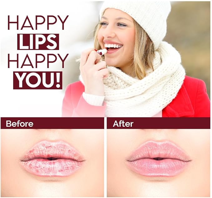 Salt Range Lip Balm with Cherry & Shea Butter – Hydrating and Soothing Lip Moisturizer for Deep Nourishment, Organic Chapstick, 12-Count Pack (24 Pieces) for Soft Lips