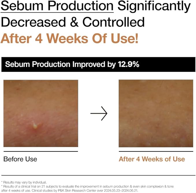 ANUA Rice 70 Glow Milky Toner, for Glass Skin, Rice Water, Niacinamide, Ceramides, Panthenol, Fragrance-Free, Non comedogenic, Fungal Acne Safe, Korean Skin Care, 250ml/8.45fl.oz.