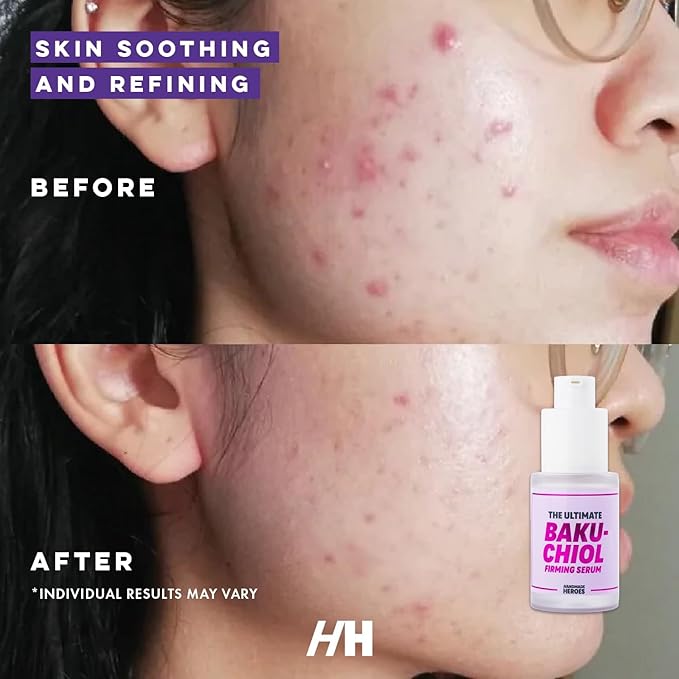 Handmade Heroes The Ultimate Bakuchiol Firming Face and Neck Lightweight Cream, Anti-Aging for Neck and Décolleté, Day & Night Face Cream - Moisturizing and Lifting