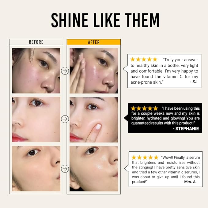 JUMISO All Day Vitamin Serum, Brightening & Balancing Facial Serum 30ml, 1.01 fl oz, 86.14% of Vitamin Tree Extract, 20,000ppm of Niacinamide