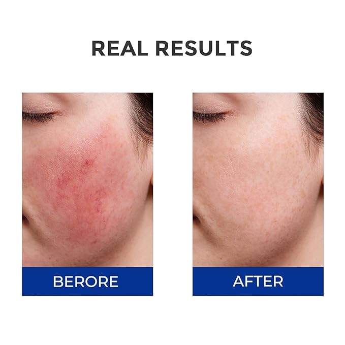 Moisturizing Barrier Serum, 4D Hyaluronic Acid Serum for Face with Vitamin B5 and Ceramides, Anti-Aging Hydrating, Plump and Repair Dry Skin, Daily Skin Care Treatment 1oz