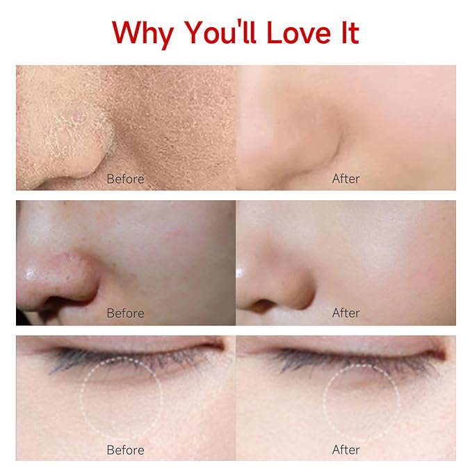 Rejuvenating Zero Pore Toner Cotton Pads with Hyaluronic Acid & MC-PDRN - Moisturizing Facial Korean Skin Care for Smooth Skin（100 Pads）