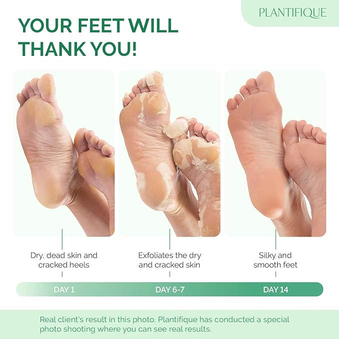 PLANTIFIQUE Foot Peeling Mask 4 Pack | Dermatologically Tested Repairs Heels & Removes Dry Dead Skin for Baby Soft Feet | Exfoliating Foot Peel Mask for Dry Cracked Feet