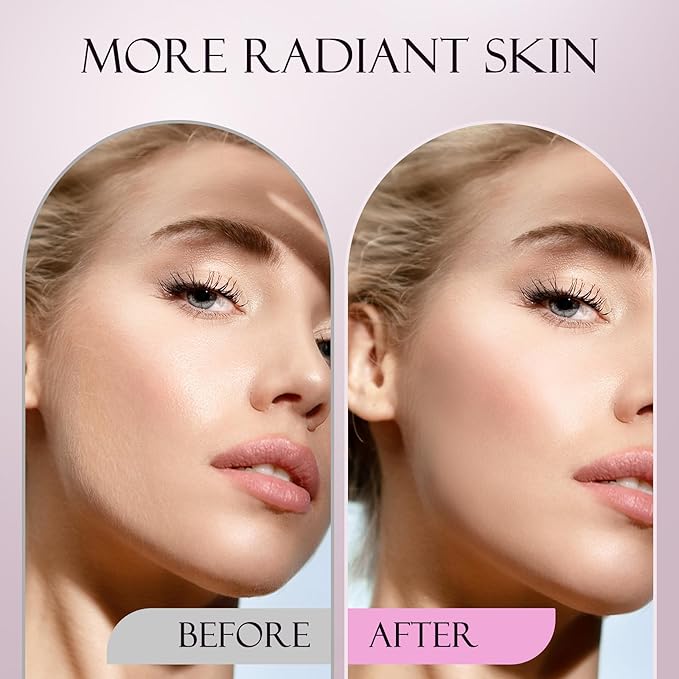 Sonic Dermaplane Razor for Women Face, Dermaplaning Tool for Face, Facial Hair Removal for Women, Sonic Edge Technology, Peach Fuzz with 16 Replaceable Blades(Green)