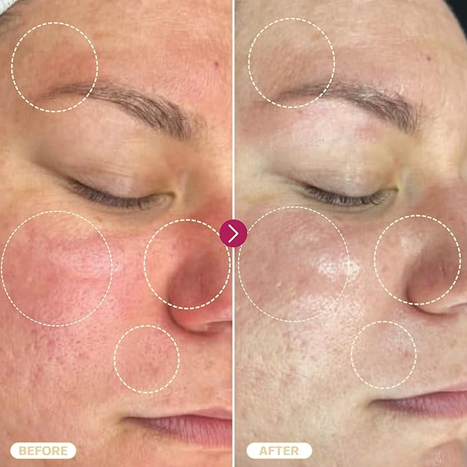 BASE LABORATORIES Hypochlorous Acid Spray for Face & Skin | 8 oz | Facial Spray Daily Skin Repair Solution for Sensitive Skin, Redness, Irritations, Eczema, Acne. Hypochlrous HOCL Molecule Spray