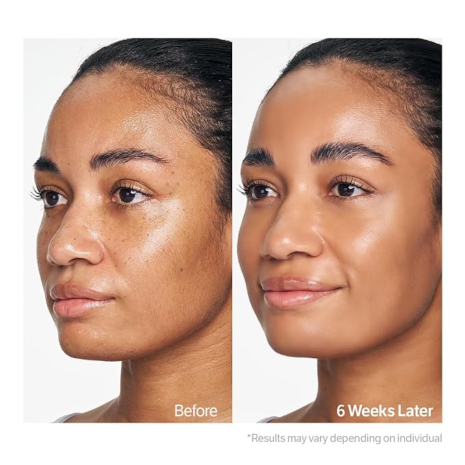 SUNGBOON EDITOR Kojic Acid Niacinamide Face Wash | Turmeric Cleanser for Dark Spots & Radiance | Korean Skin Care with Hyaluronic Acid | Gentle Makeup Remover & Blackhead Cleanser