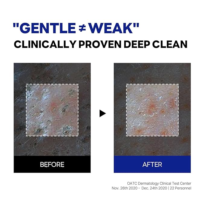 ROUND LAB Birch Juice Moisturizing Cleanser | Unclogs hidden sebum, Clears away dead skin cells., Soothing, Low pH, Gel Type Cleanser (5.07 fl.oz)