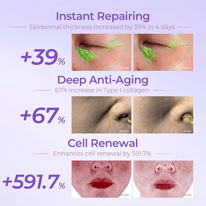 Repair Face Cream (55g/1.94oz) - Facial Essence Moisturizers with Peptides & Hyaluronic Acid & Ceramides for Renew Resurfacing, Visibly Hydrates & Plumps Skin