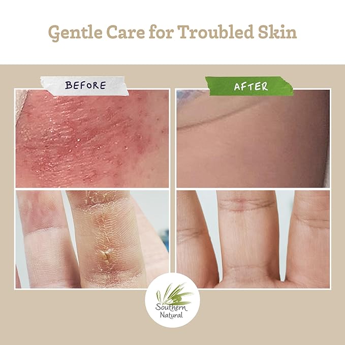 Southern Natural Goat Milk Soap Bar (3 Pack - Tea Tree Peppermint) For Dry, Sensitive Skin. Natural Handmade Soap For Men, Women and Kids. Great For Face & Body.