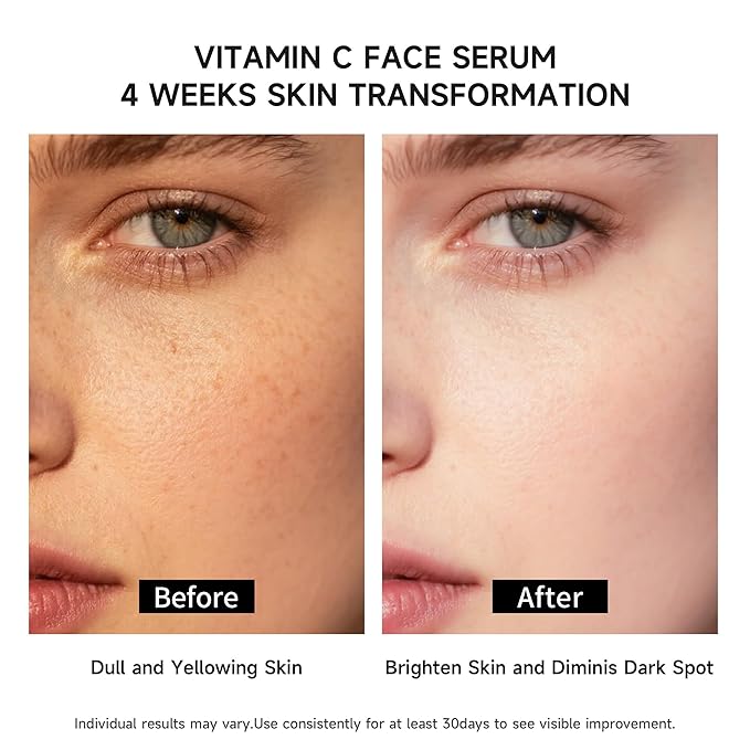 Vitamin C Face Serum with Glutathione, 4D Hyaluronic Acid & Aloe Vera – Lightweight Brightening & Hydrating Ampoule for Daily Skincare, Dark Spots, Sensitive Skin Friendly - (1.0 ml)*30 Vials