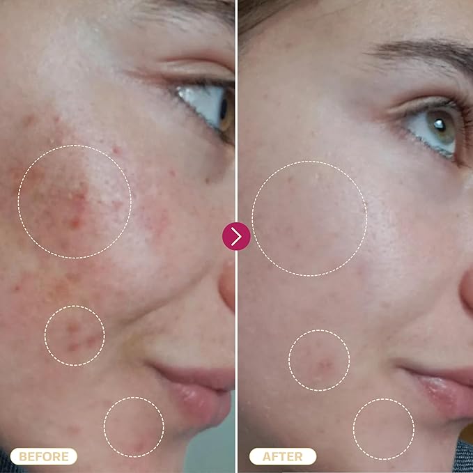 BASE LABORATORIES Hypochlorous Acid Spray for Face & Skin | 8oz | Facial Spray Daily Skin Repair Solution for Sensitive Skin, Redness, Irritations, Eczema | Hypochlrous HOCL Molecule | 2PK