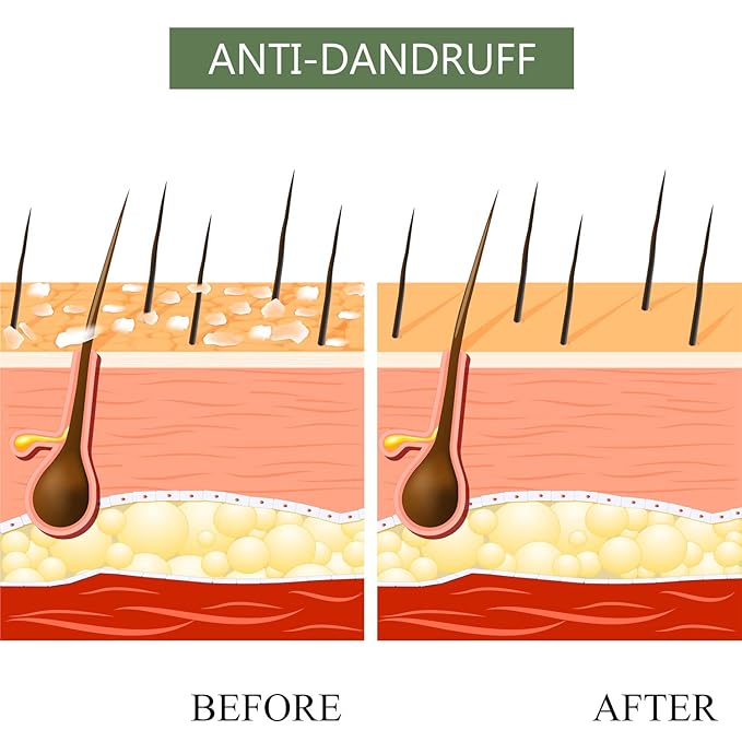 Luseta Tea Tree & Argan Oil Detangling Shampoo & Conditioner Set, 2 x 33.8 Oz