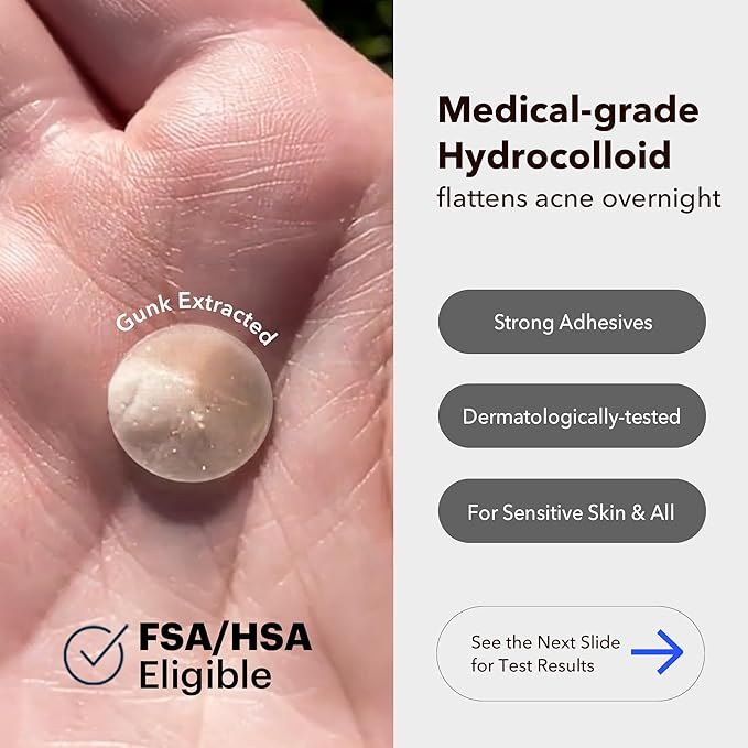 AVARELLE Pimple Patches for Face | Hydrocolloid Acne Patches for Covering Blemishes | FSA HSA Store Eligible Zit Patches with Tea Tree, Calendula, & Cica | (10-14 mm, 300 Count) Bulk Pack