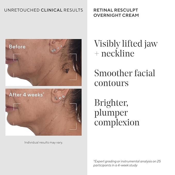 Murad Retinal ReSculpt Overnight Cream – Anti-Aging Face & Neck Cream with Encapsulated Retinal & NAD+ – Firms, Lifts & Hydrates Skin – 1.7 Fl Oz