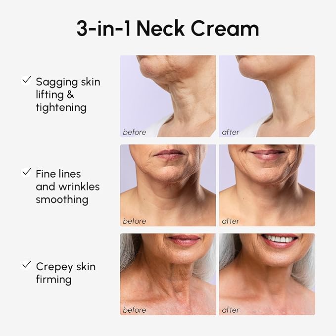 MAREE Neck Cream with Face Roller – Neck Creams For Tightening and Firming – Pro Retinol & AH-8 Firming Neck Cream Roller - Face Double Chin Wrinkle Cream for Women - Crema Reafirmante Para el Cuello