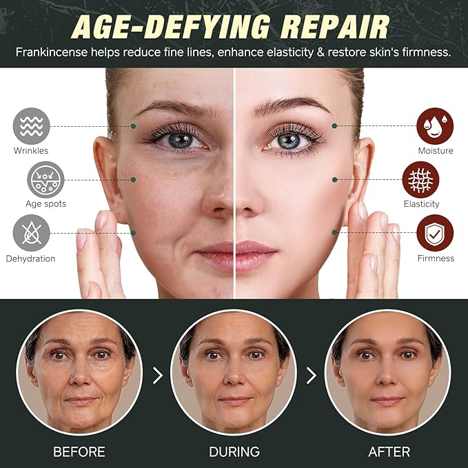 Handmade Tallow, Organic Castor Oil, and Frankincense Oil Face Balm, 100% Grass-Fed Tallow for Skin Care, Face & Body Moisturizer for Sensitive Skin & Dry Skin Age Defying, Natural Lotion