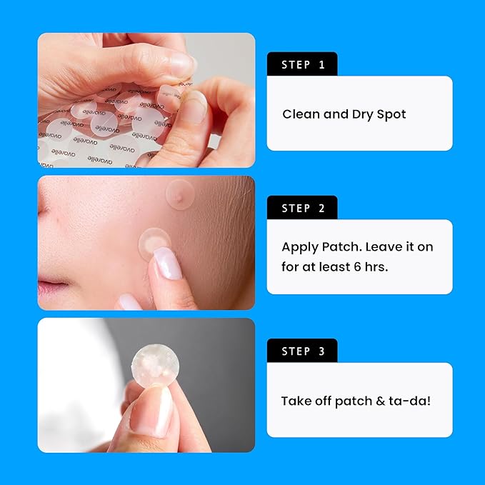 AVARELLE Acne Cover Patches, Eligible Hydrocolloid Pimple Patches for Face with Tea Tree Oil, Korean Skincare Zit Patches for Face | HSA Store Eligible Items | Vegan, Cruelty-free