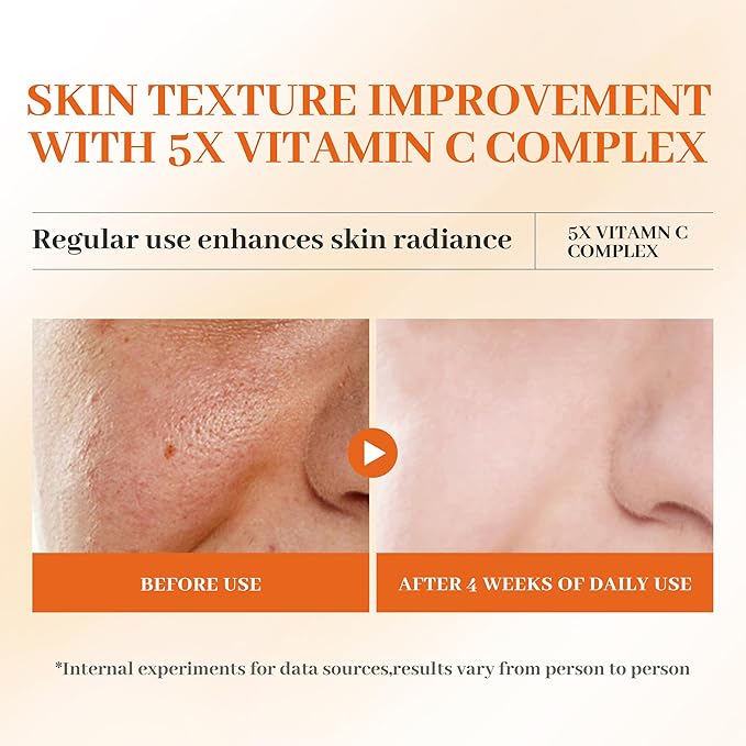 Premium 5X Vitamin C Face Toner, Facial Care Toner, Hyaluronic Acid Hydrating Facial Treatment for Even Skin Korean Tone, Safe Glowing Skin 130ml,K-Beauty,Tiktok Morning & Evening Skincare Women Gift