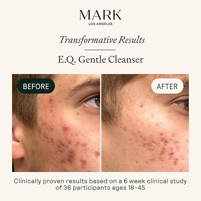 EQ Gentle Cleanser - EGCG + Quercetin - Gentle Face Wash - Cleanse & Purify Skin - For Redness & Blemishes - With Squalene Oil - Lightweight Plant-Based Formula - 4.05 fl oz