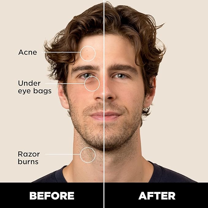 Stryx Concealer Stick Tool for Men, Medium Mahogany - Natural Pigments Hides Imperfections, Acne, Razor Burns, Scars, & Rosacea - Highly Adaptable Shades for Easy, Undetectable Coverage