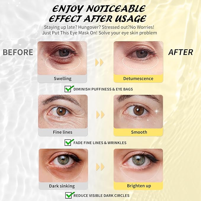 Under Eye Patches (24 Pairs), 3 Colors Eye Masks Gift Set for Dark Circles Puffy Eyes, Undereye Bags and Wrinkles, Bachelorette Party Favors, Skin Care Set Gifts for Women