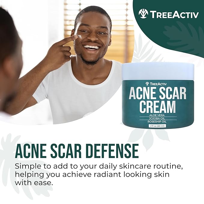 TreeActiv Acne Scar Treatment, 2 fl oz, Scar Cream for Face and Dark Spot Remover, Lotion for Stretch Marks and Body, Acne Scar Removal for All Skin Types, 500+ Uses