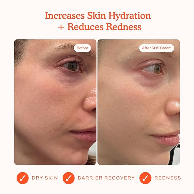 Tower 28 Beauty SOS Daily Skin Barrier Redness Recovery Moisturizer 1.86 oz / 52.73 g