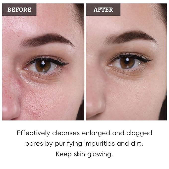 Face Mask Set, 4Pcs Clay Mask, Face Masks Skin Care with Vitamin C, Charcoal, Mugwort and Purple Clay, Skincare Gift Set for Blackheads, Refining Pores & Controling Oil, Dry Oily Skin