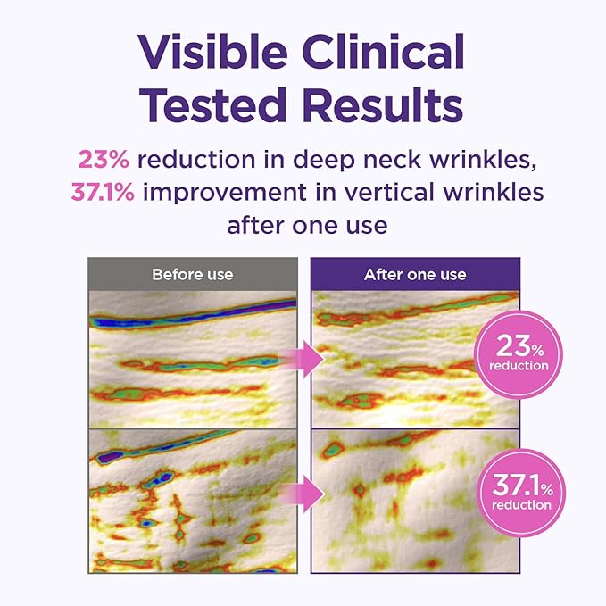 CKD Gua Sha Neck Cream Filltocshot - Advanced Anti-Aging Neck Firming Cream with Massage Roller. Visibly Reduces Wrinkles, Lifts & Tightens Sagging Skin, Boosts Elasticity, Korean Skincare, 1.69 fl oz