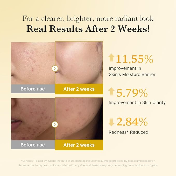 medicube Kojic Acid Turmeric Clarifying & Balancing Capsule Serum for Troubled Skin | Soothing & Brightening Facial Serum | Niacinamide & Glow Capsules for Hydration and Barrier Support | 1.01 fl.oz