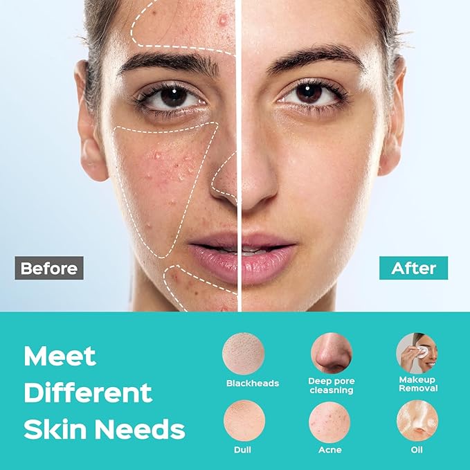 COSLUS Facial Cleansing Brush Face Scrubber : Silicone Waterproof Rechargeable Face Wash Brush, 5 Cleansing Modes, Electric Deep Cleaning for Men & Women, Removing Blackhead, Exfoliating, Massaging