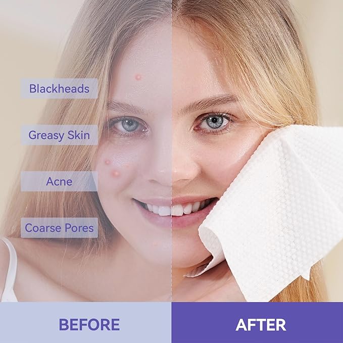 Disposable Face Towels, 10"×12" XL Face Towelette Disposable, Soft Makeup Remover Dry Wipes, Thick Facial Tissue for Women Cleansing, Skin Care, 50 Count (2 Pack)