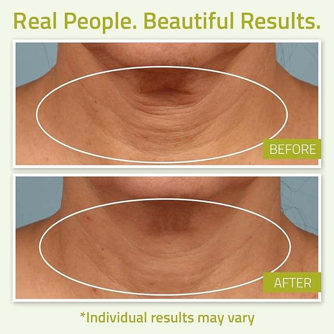 YEOUTH Neck Cream with Vitamin C, Moisturizing Neck Firming Cream for Women and Men, Targeting Decolletage and Double Chin, Cleavage and Chest 4oz