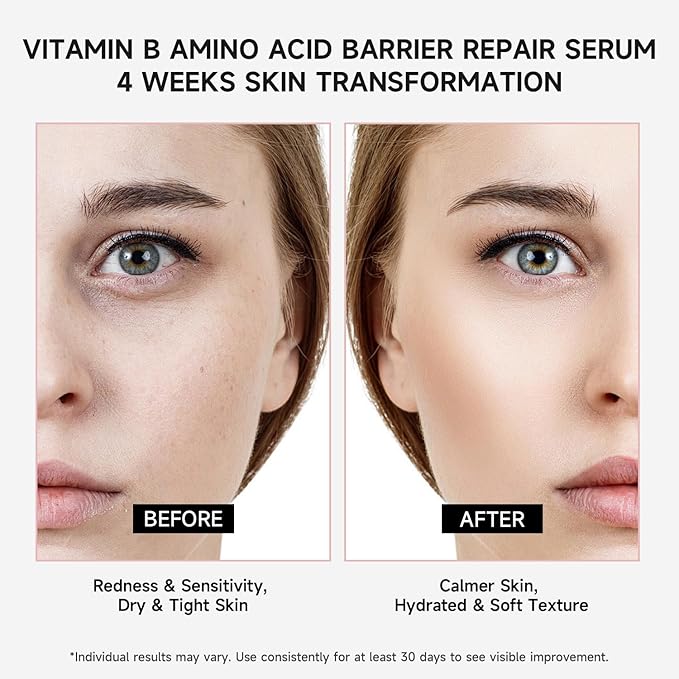 Vitamin B Amino Acid Barrier Support Face Serum - Preservative-Free Ampoule with B12, Hyaluronic Acid and Glutathione for All Skin, Especially Sensitive, Dry and Fragile Skin (1.5ml)30 Vials