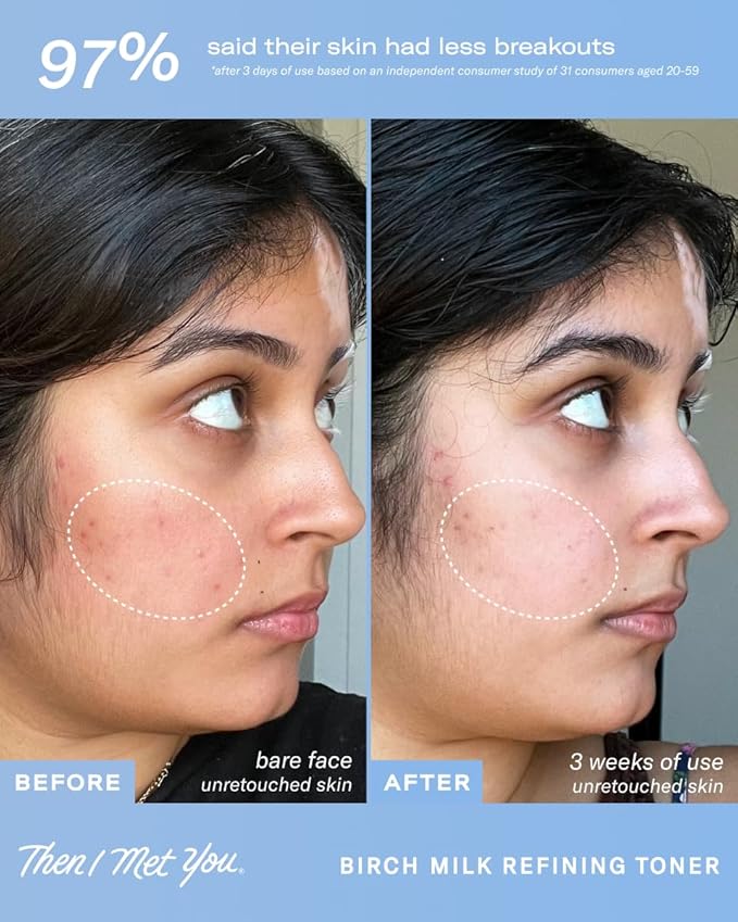 Then I Met You Birch Milk Refining Toner, Exfoliating & Hydrating Face Toner with Birch Juice, AHAs & PHAs, Vegan & Clean Skincare, 3.38 oz