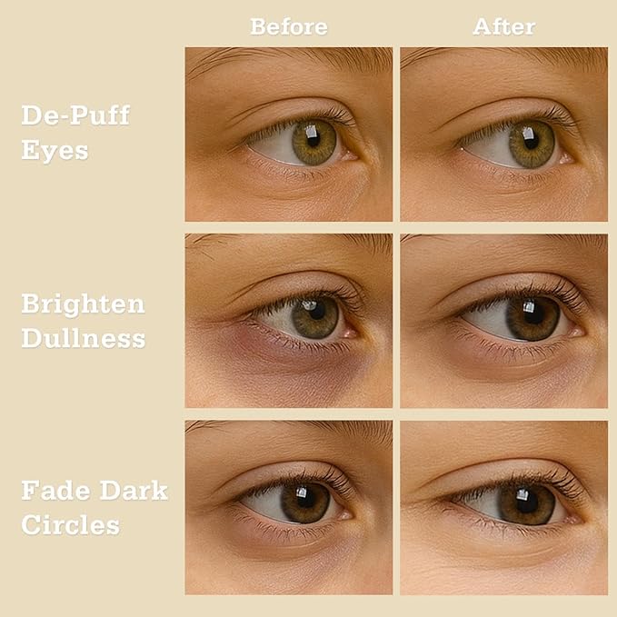 Oat Calm Repair 5′ Hydrogel Under-Eye Patches, 28 Pairs — 5-Minute Soothing for Sensitive Skin, Deep Hydration & Barrier Support — Ophthalmologist Tested