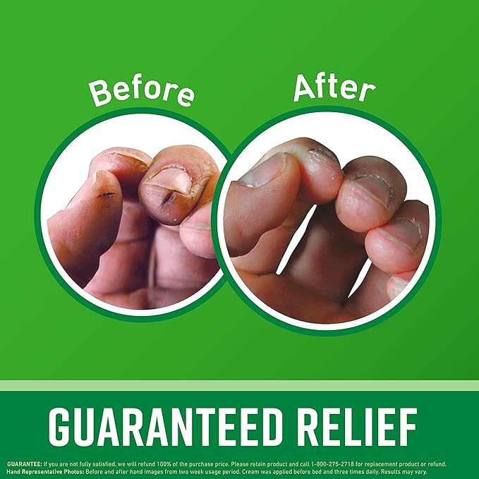 O'Keeffe's Giftbox Including Lip Repair with Cherry and Vitamin E Oil Stick, Working Hands Jar and Healthy Feet Jar, Gift Idea