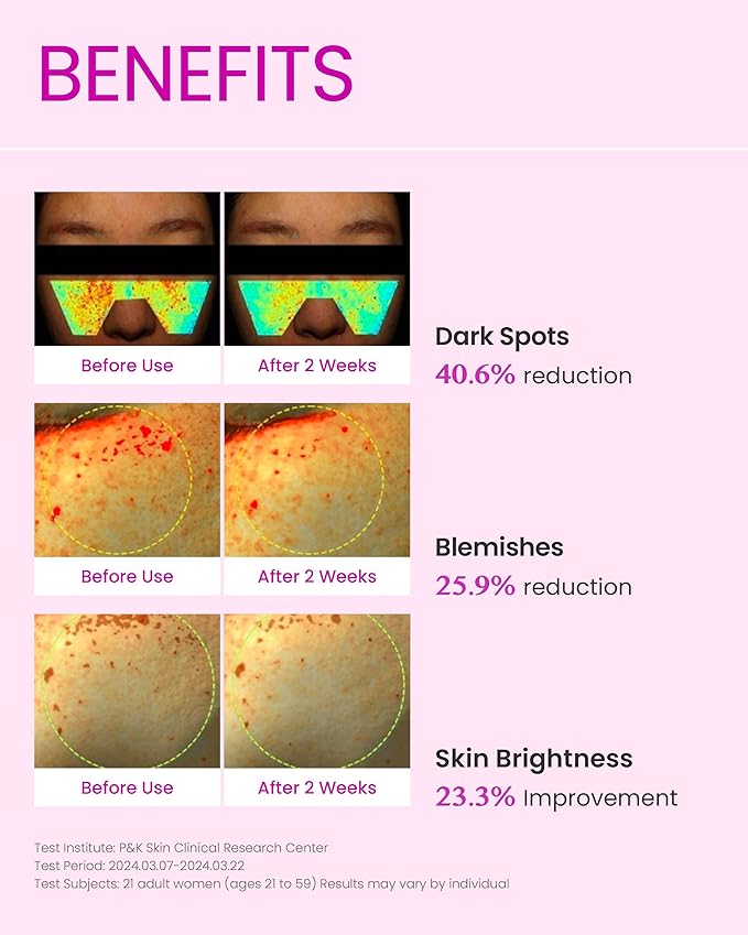 AtClinic DOMINAS Tranexamic Acid Pink Serum (1fl oz) - Improve Skin Tone and Hyperpigmentation, Ampoule for All Skin Types. Korean Skin Care. Niacinamide