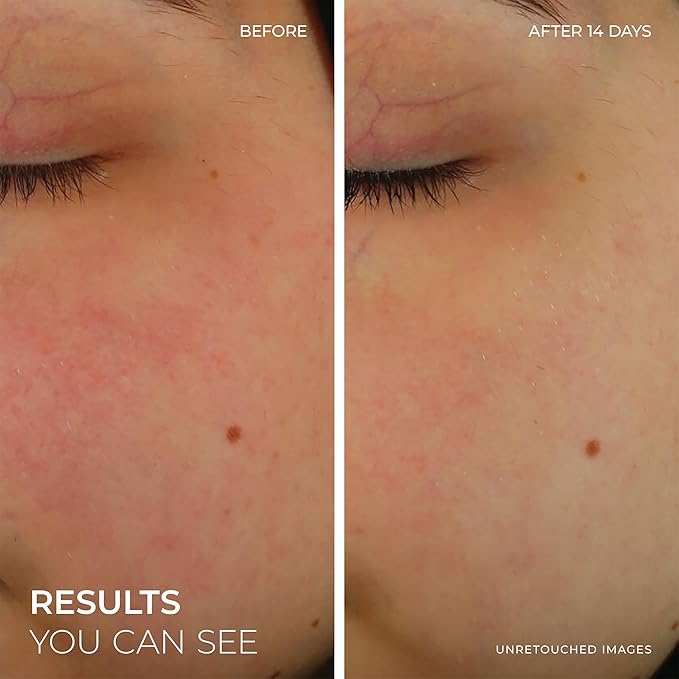 RoC Barrier Renew Bundle: Night Moisturizer, 2.5oz + Day Cream with SPF 30, 2.5oz + Barrier Renew Gel to Foam Non Drying Cleanser, 12oz