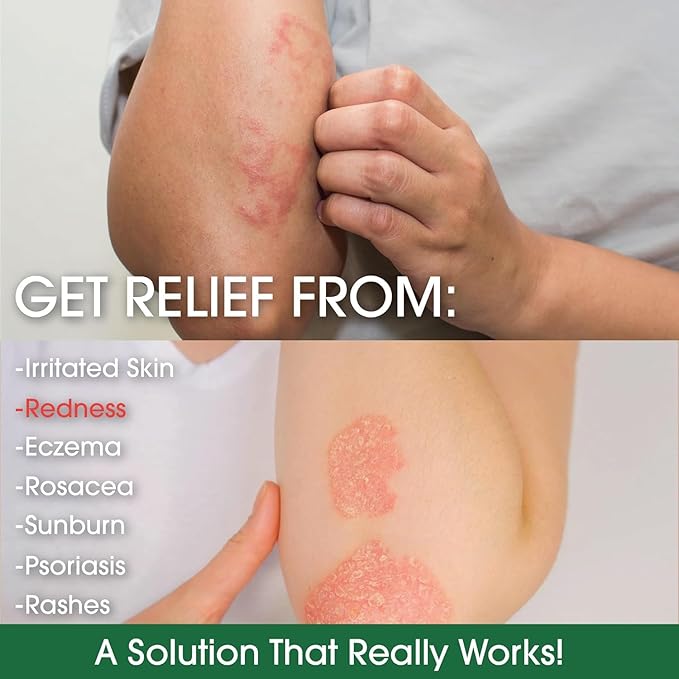 Green Leaf Naturals - Manuka Honey Face Cream - 16oz -Aloe Vera - Jojoba Oil Infused - Body Cream - Gluten Free Moisturizer for Kids & Adults - Nourishing Skin Care