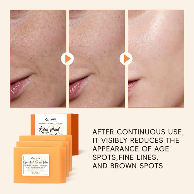 Kojic Acid Turmeric Soap, Dark Spot Remover for Face, Skin Care Sets, Facial Skin Care Products, Even Skin Tone, Moisturizing & Nourishing, 3 Pack+ African Net Sponge