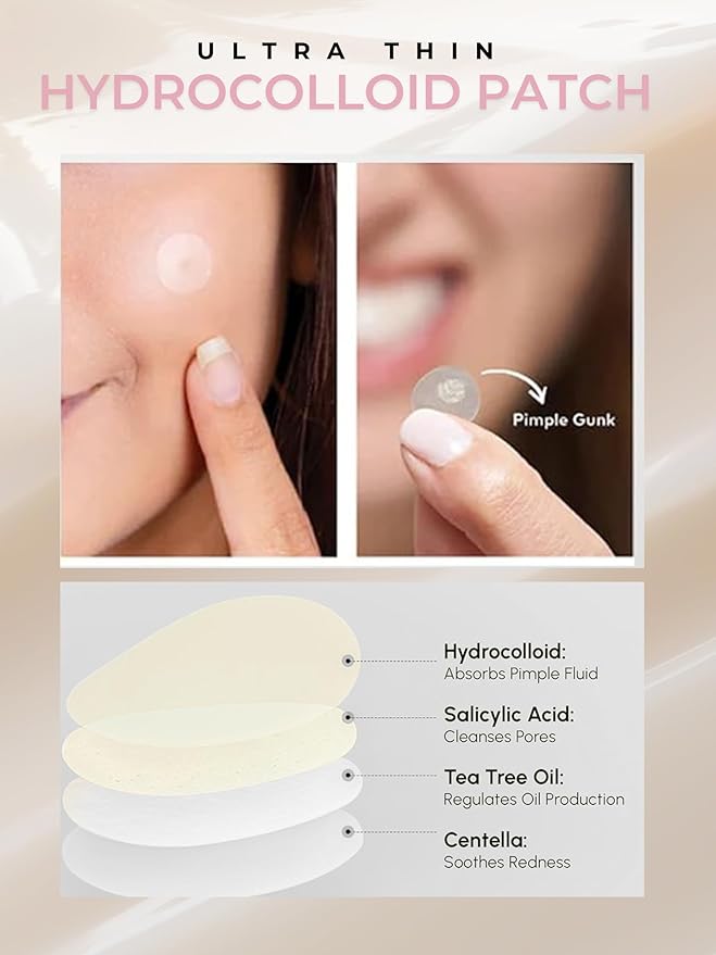 Pimple Patches- Advanced Skincare Treats Acne and Blemishes. Hydrocolloid Spot Treatment with Salicylic Acid & Tea Tree Oil- Acne Patch for Face- 72 ct